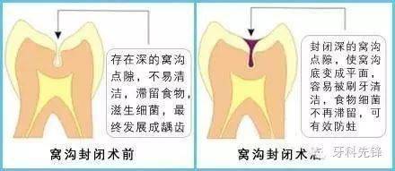 剛剛萌出的