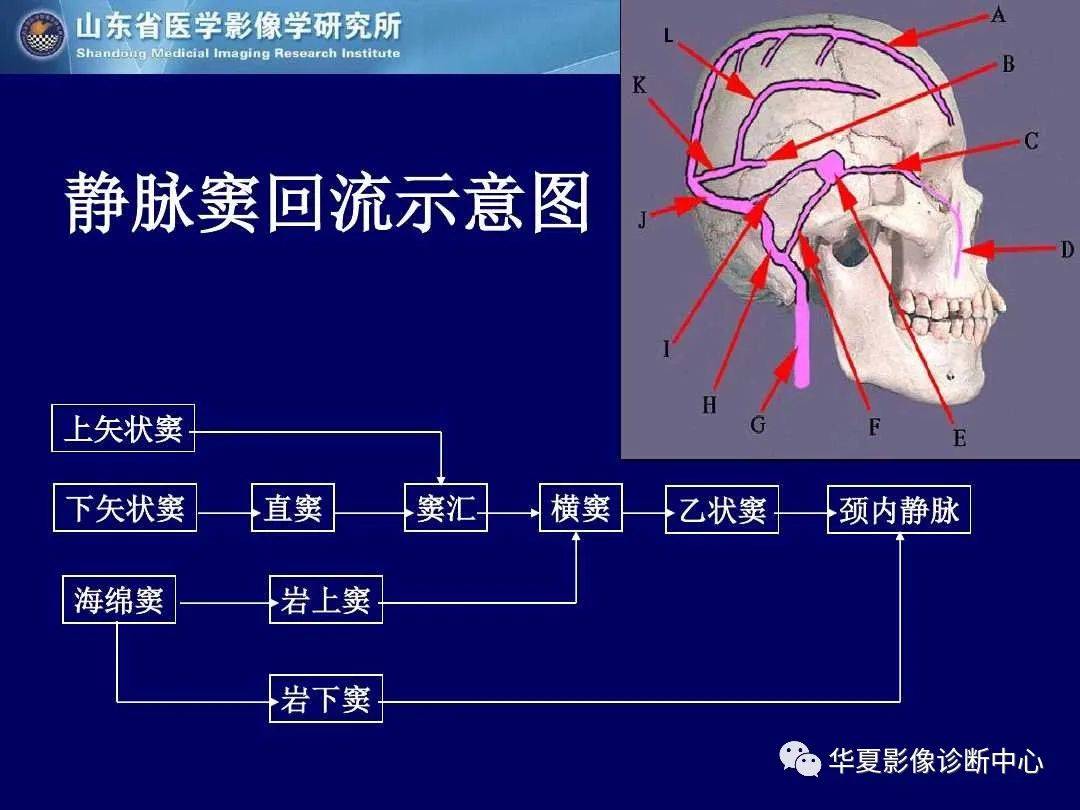 诊断|缺血性脑血管病的影像诊断