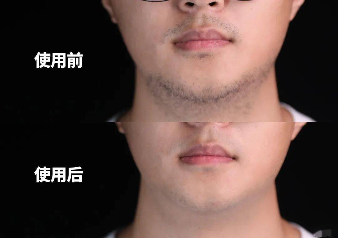 黑头成熟男人才懂的秘密：什么样的男生最吸引异性？