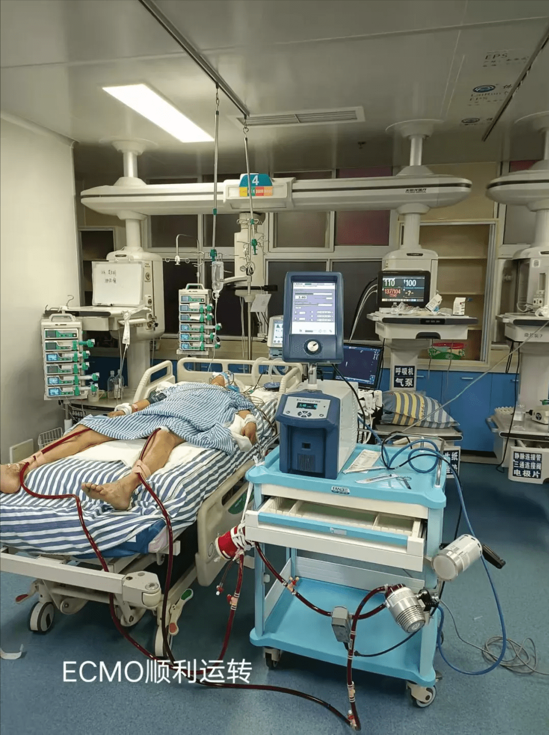 最终在重症医学科医护团队的集体努力下迅速精准穿刺建立血管通路让