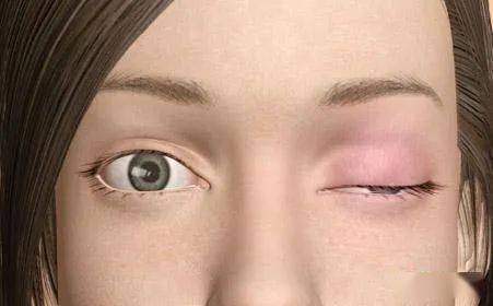 眼皮抬不起是怎么回事?