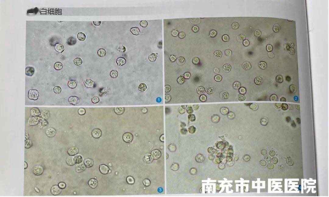 健康醫聲尿液檢驗那些事