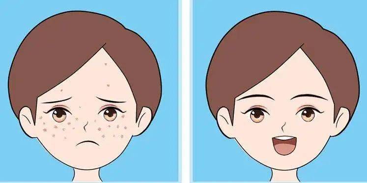 治疗松江医生为你揭秘超皮秒的神奇之处→