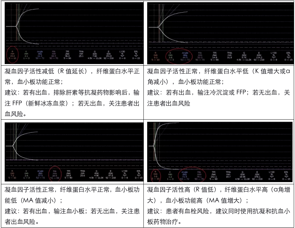 血栓弹力图化验要多久图片