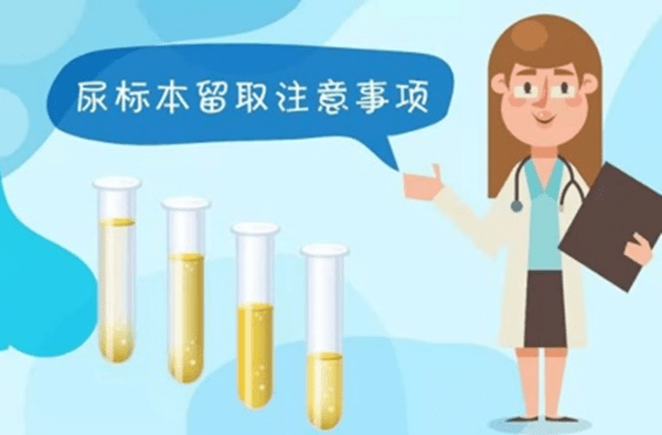 漲知識|尿常規標本,你留對了嗎?_檢查