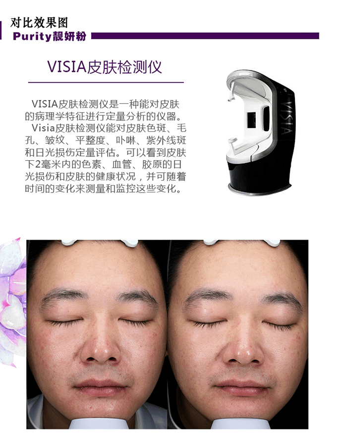 余甘拍1发10：美白饮清货最后几十组！