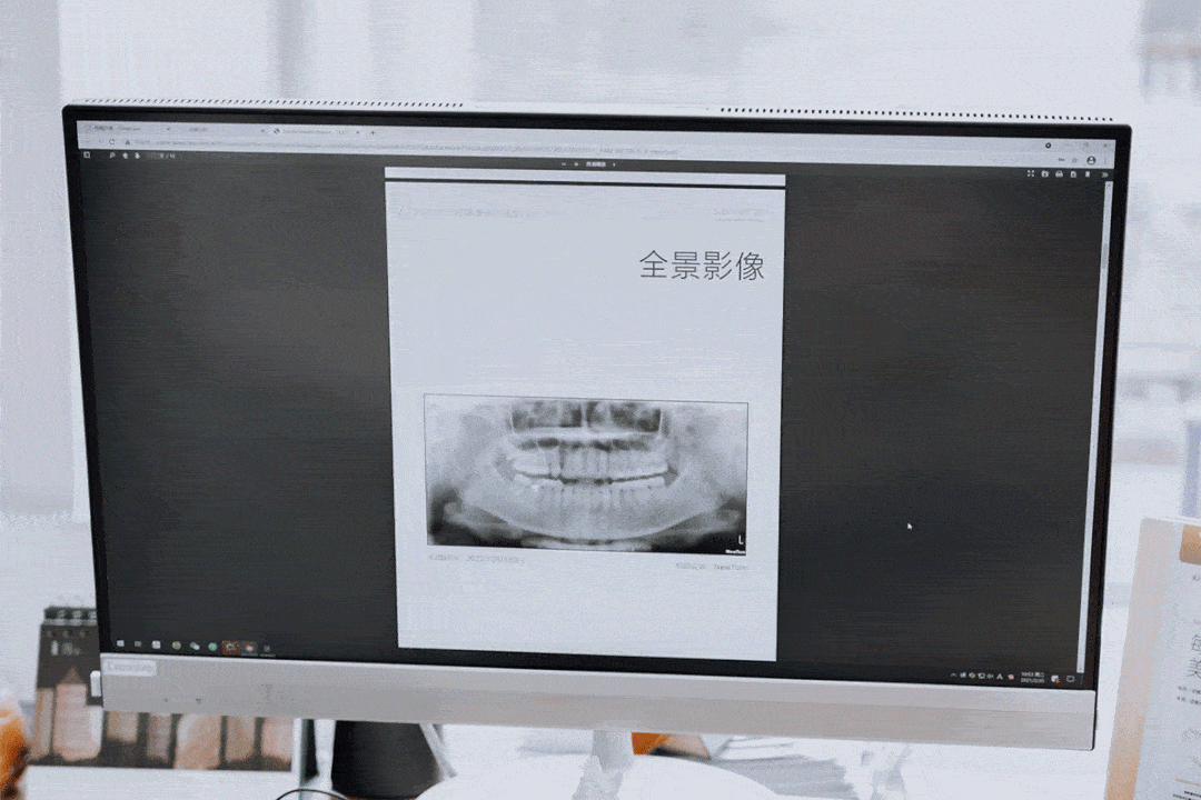 牙齿检查报告图片