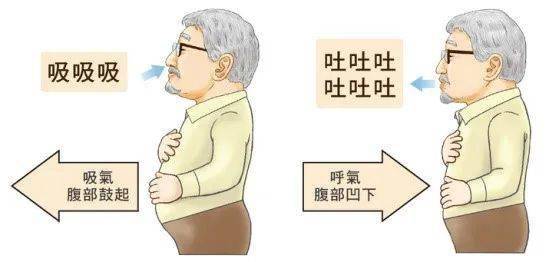 疫情|世界慢阻肺日 | 疫情期间，慢阻肺患者如何做好自我管理，健康呼吸？