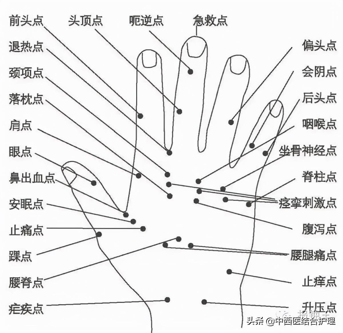 22,关节酸痛五指尖各井穴,手背虎金寸,阳池穴