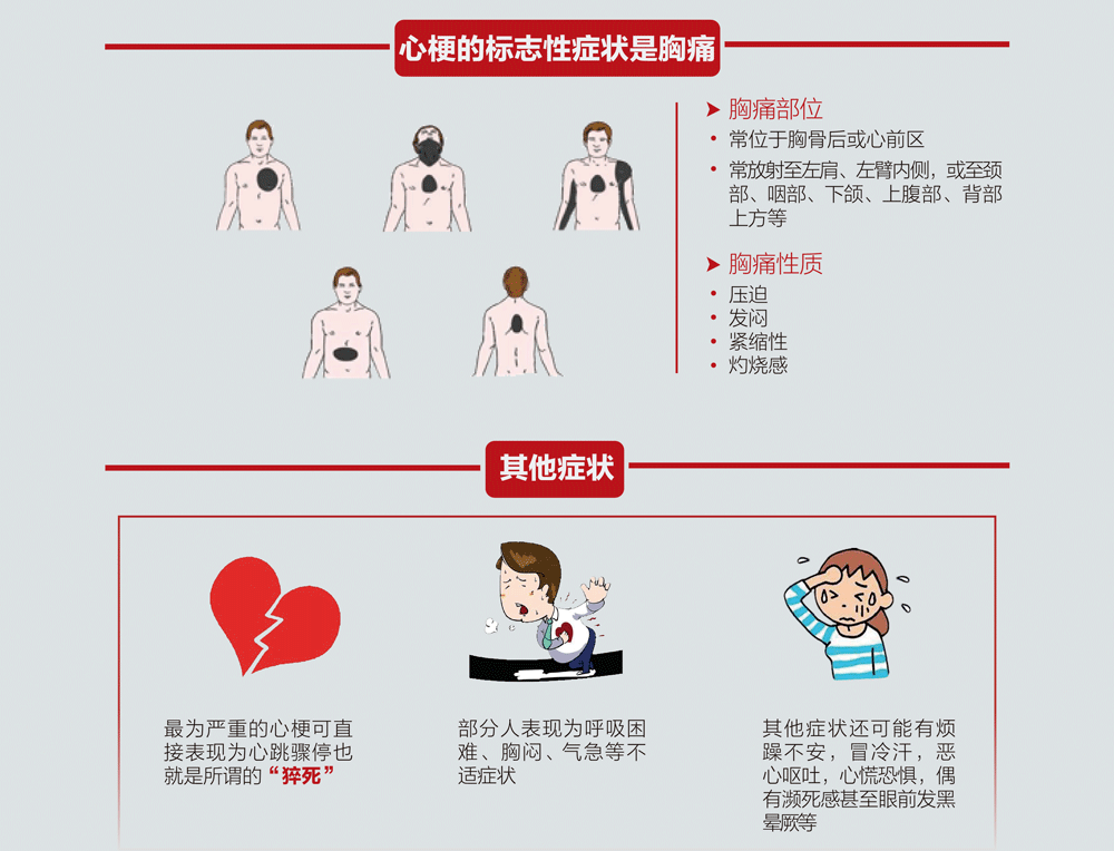 心肌梗塞的症状图片