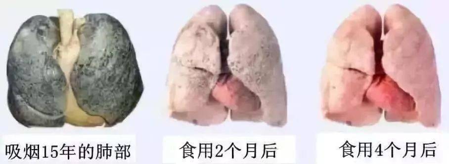 嗓子又幹又癢還老咳嗽每天吃個它潤肺止咳排出肺裡的毒