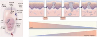 高低|“高低”搭配狙击早期癌症，这两项研究成为高价值专利