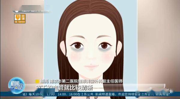 胡亮|南京一医院开设黑眼圈门诊！网友沸腾了：马上去挂号！