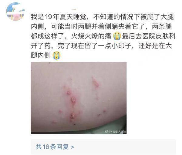 这种虫，是会飞的“硫酸”