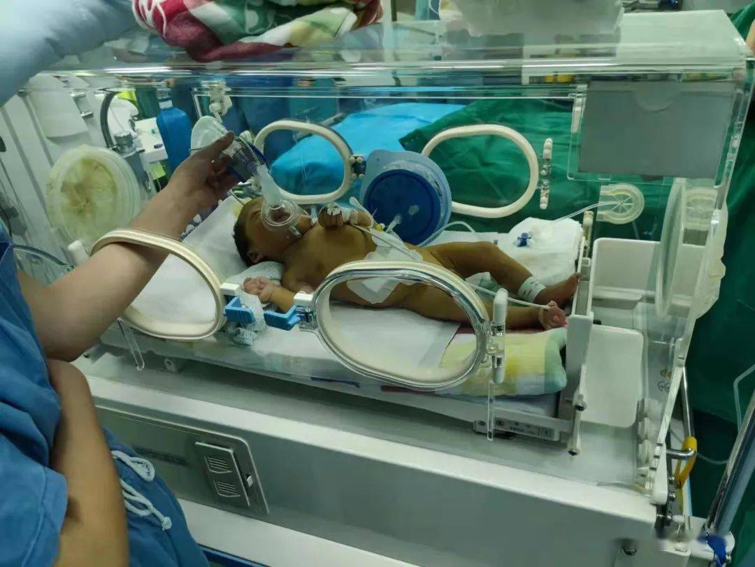 术精岐黄丨淄博市妇幼保健院成功为出生仅20天新生儿实行腹腔镜微创