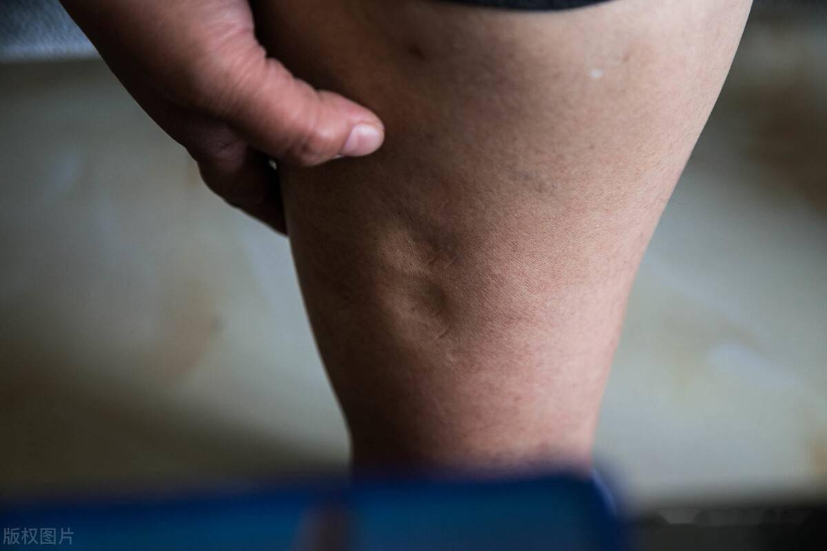 温补阳气的秘方保元汤可以用来治疗肾虚肾病冠心病