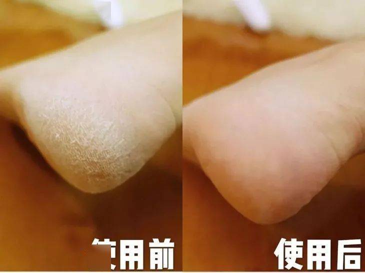 羊奶女生涂身体乳 vs 不涂身体乳，这差别也太大了吧！
