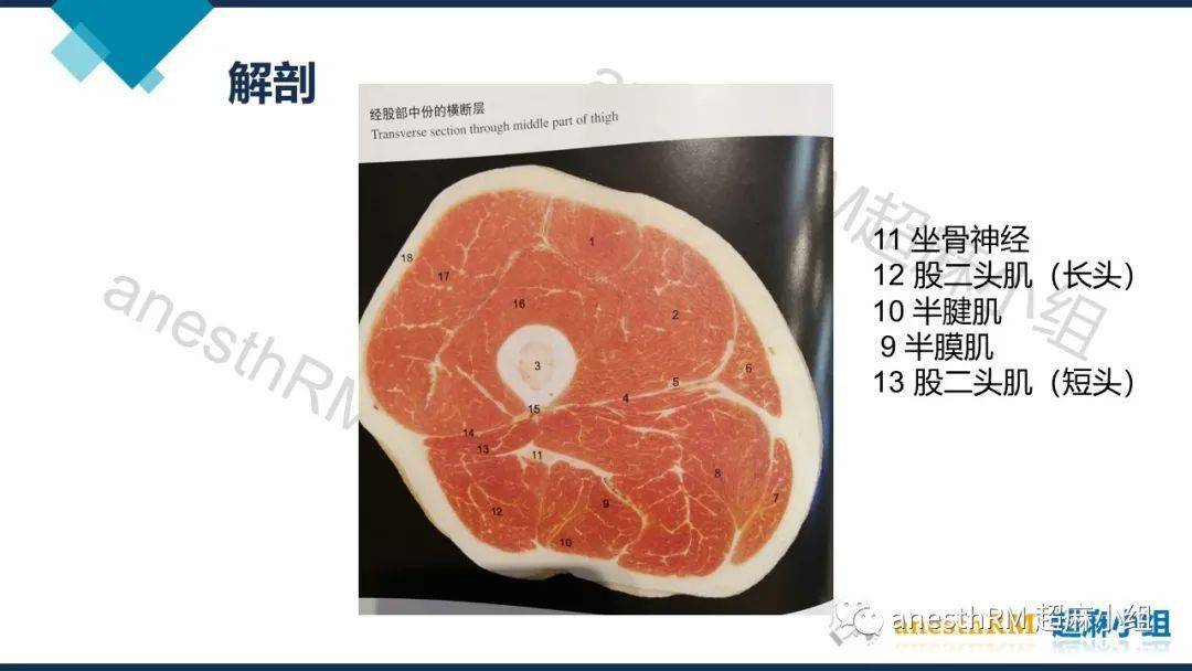 超声引导下腘窝坐骨神经阻滞