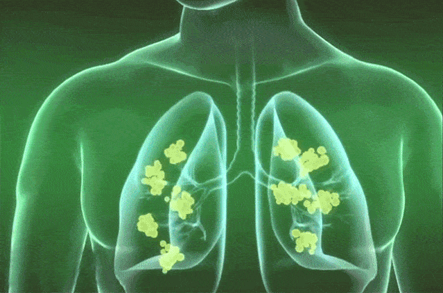 生活|提个醒：早晨起床，第一件事不是排便，也不是喝水，空腹喝它