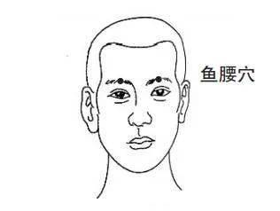 鱼尾纹,近视,斜视功用:疏经活络定位:眉峰,归属经外奇穴鱼腰穴02主治