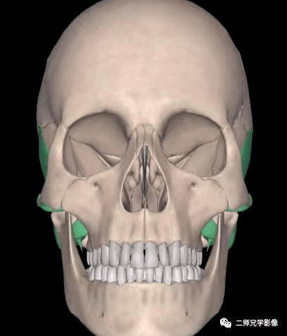 新发现一种茎突正位拍摄方法一次曝光成功你值得拥有