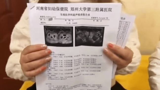 什么是超声检查报告 2a502f78d94a4ad88ff3b2a82acdb745.png