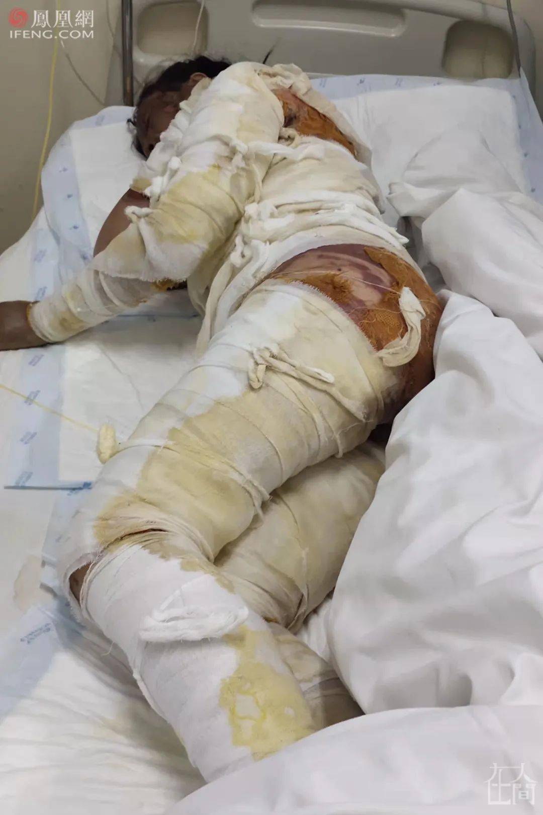 烧死母亲的头号嫌疑人是父亲