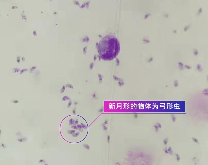 涮个肉也能感染弓形虫?