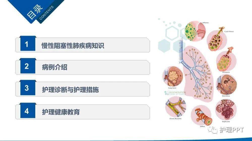 護理ppt老年慢性阻塞性肺疾病護理