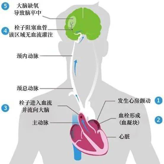 大脑|智慧大脑 健康你我|小鹿乱撞别忽视，心动的感觉要重视