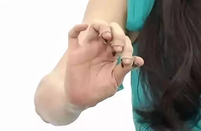 古筝知识袁莎老师摇指的详细图解