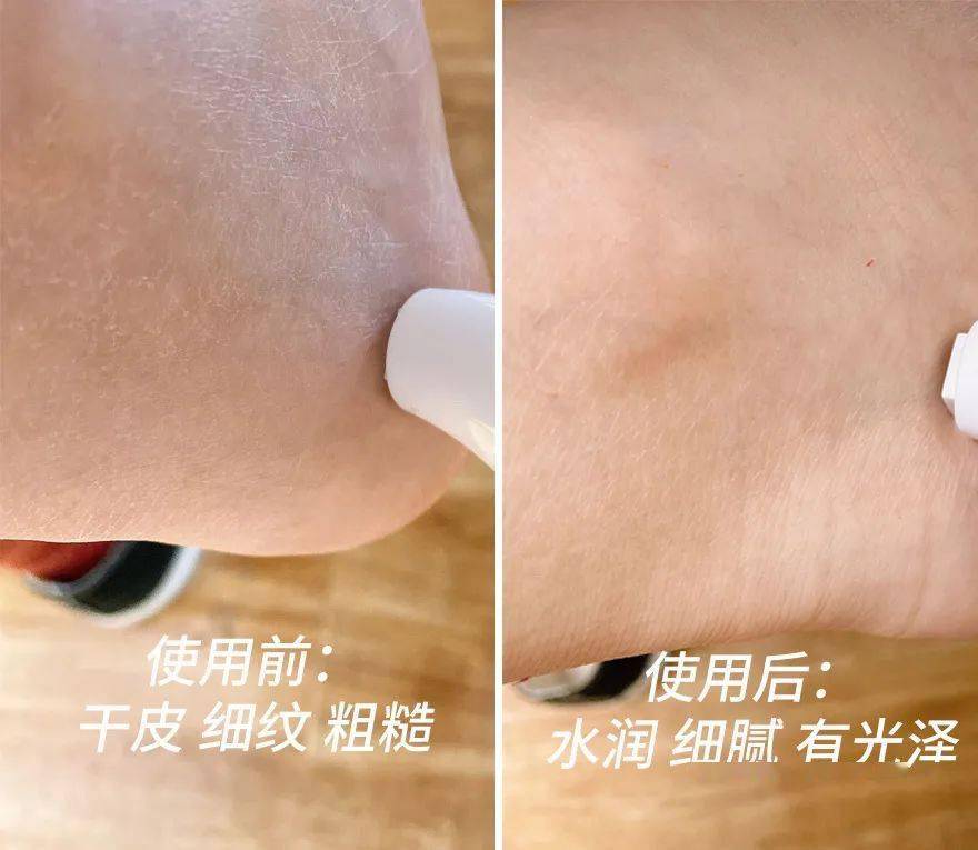 草本植物脚跟开裂、老茧、死皮……又疼又丑！用它一抹，双脚嫩滑，实测惊呆了！