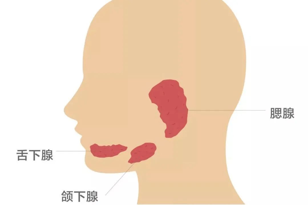 腮腺區域有一個圓形的表面光滑的可以活動的包塊,如果這個腫瘤發生在