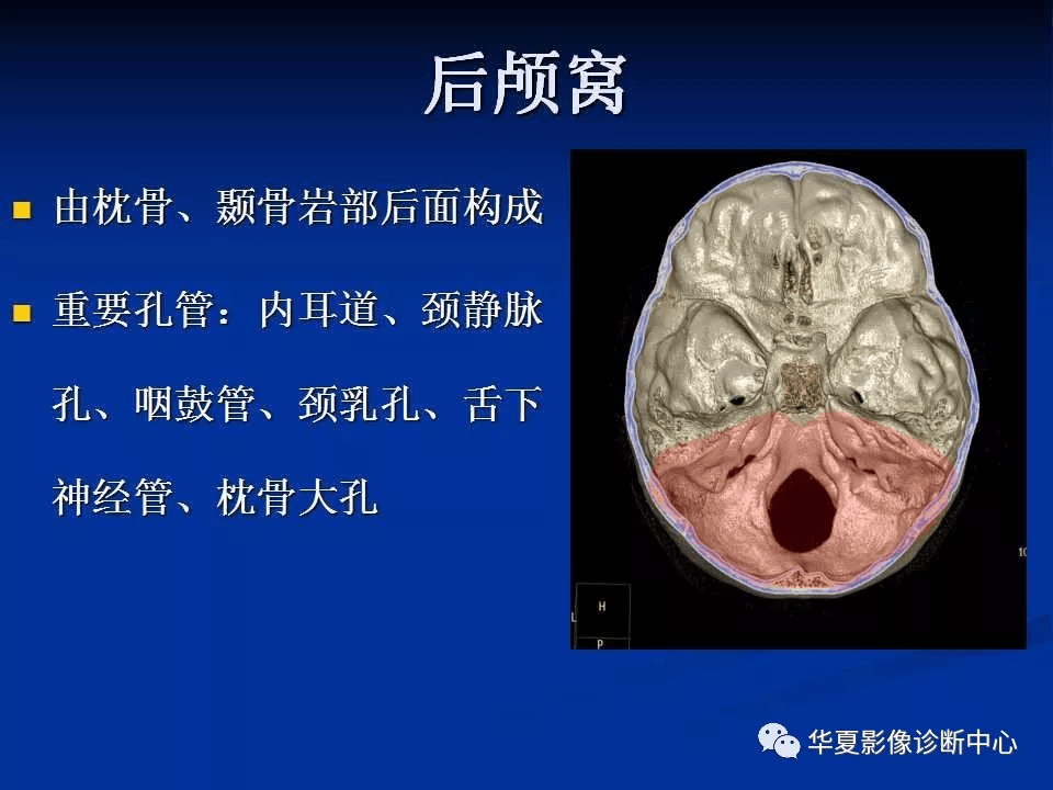实用、详细的颅底各孔道影像解剖_结构_动脉_神经