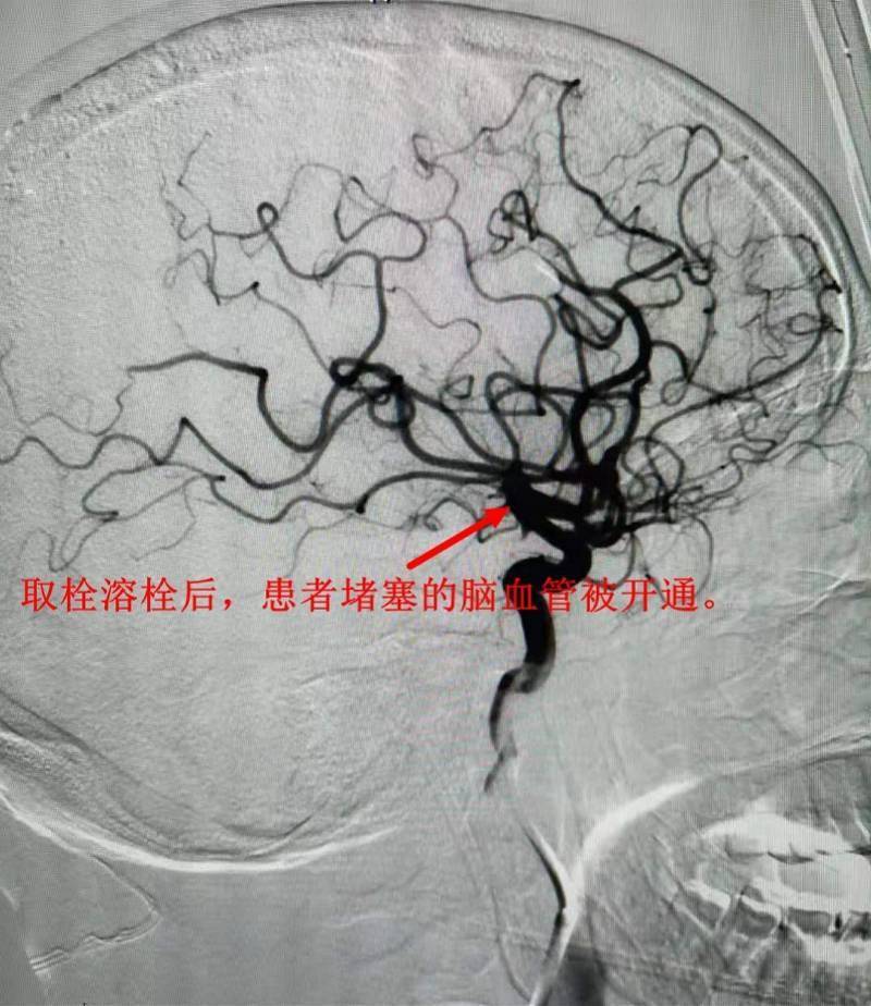 罗女士|深圳天气早晚转凉，这种病到了高发期,老年人尤其要注意！