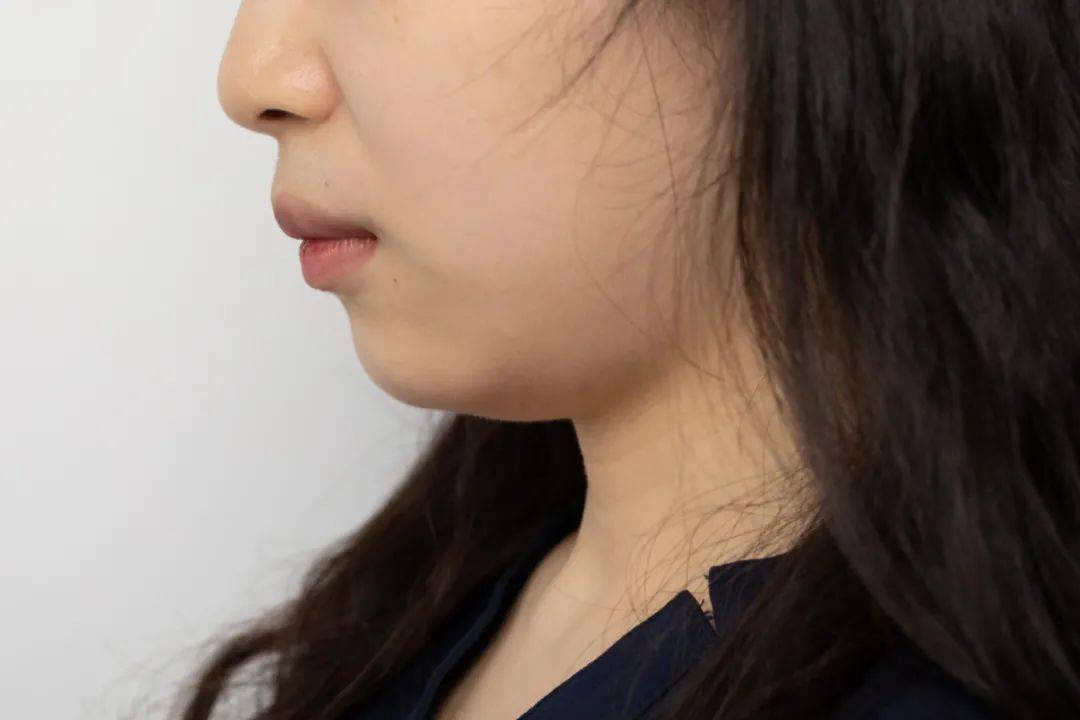 凯特36岁艳绝皇室？英国王妃凯特近照美翻！网友看到键盘都敲烂了