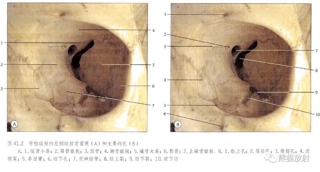 解剖丨眼眶眼球