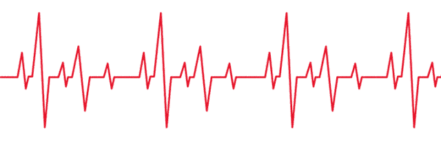 新疗法市一医院首次实施marshall静脉无水酒精化学消融导管射频消融术
