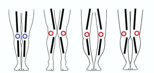 离开ps的李小璐据说1米4 还有健身狂魔袁姗姗的腿 竟然比阿娇还粗 大腿 身材 膝盖