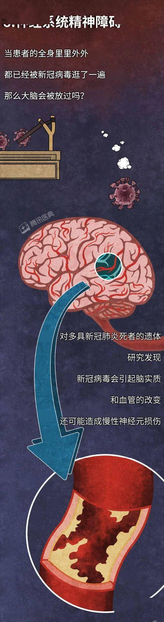 病毒|最早感染新冠病毒的人，后来怎么了？新冠最全后遗症曝光！