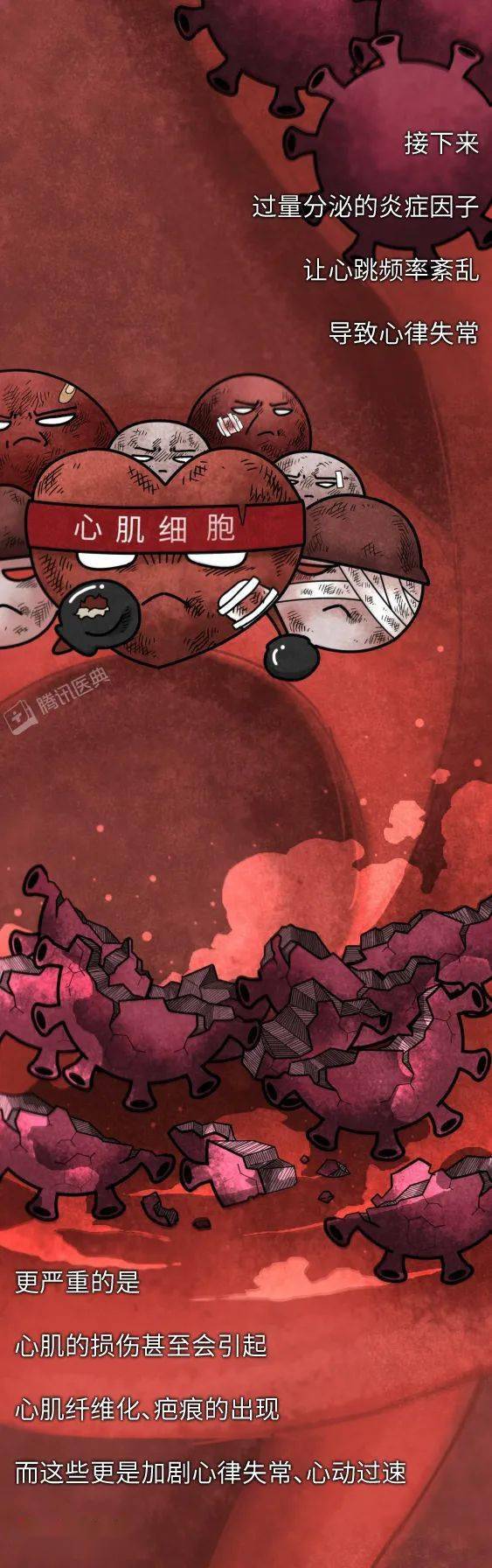 病毒|最早感染新冠病毒的人，后来怎么了？新冠最全后遗症曝光！