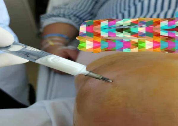 mol|每天喝十几瓶啤酒，一男子体内抽出“牛奶”