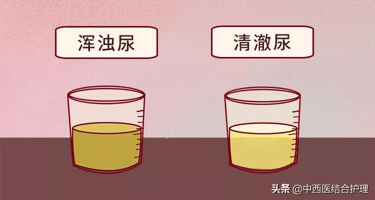 「健康科普」你的尿里有泡沫吗?