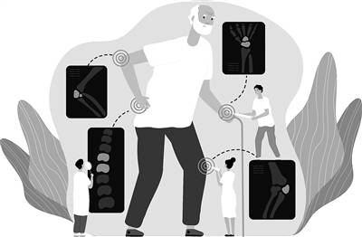 关节|关节被定住 警惕类风湿关节炎