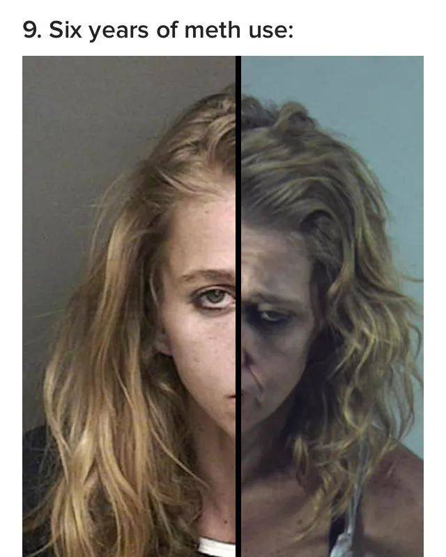 吸毒前和吸毒后的照片图片