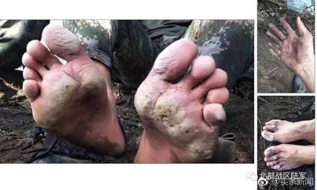 你看过消防员救火后的手脚吗看完照片网友动容