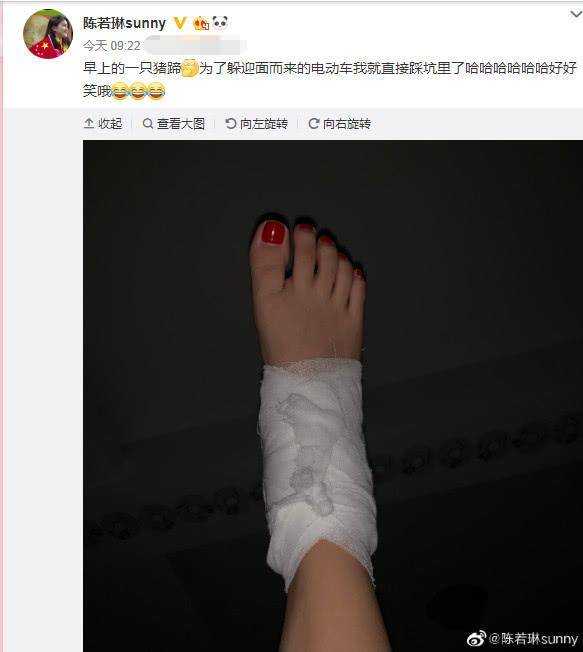 们与陈若琳的互动吧:在文字下面,就是她晒出的一只加了绷带的红肿脚丫