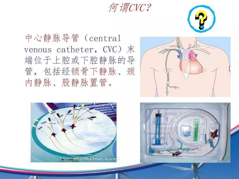 双腔cvc管的结构图图片