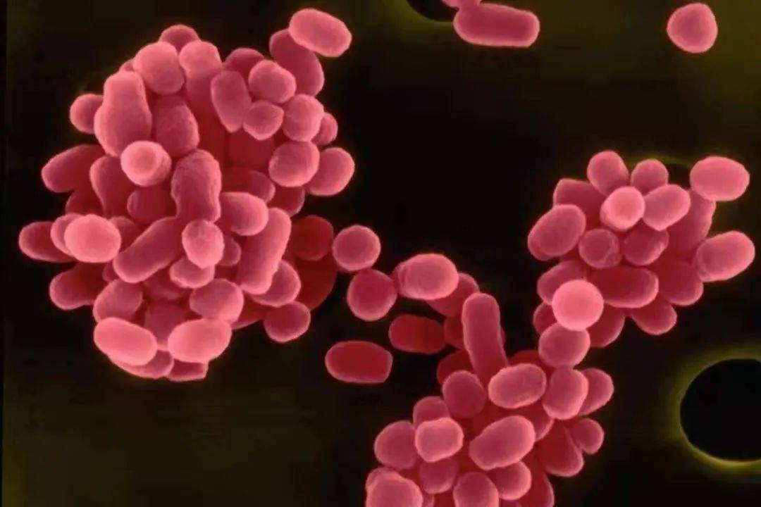 阴性菌 来自搜狐网