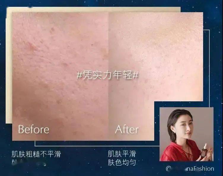 节日全年仅一次！888元到手雅诗兰黛限定礼盒，一次get精华、眼霜、眼影... 12件明星单品限量抢！